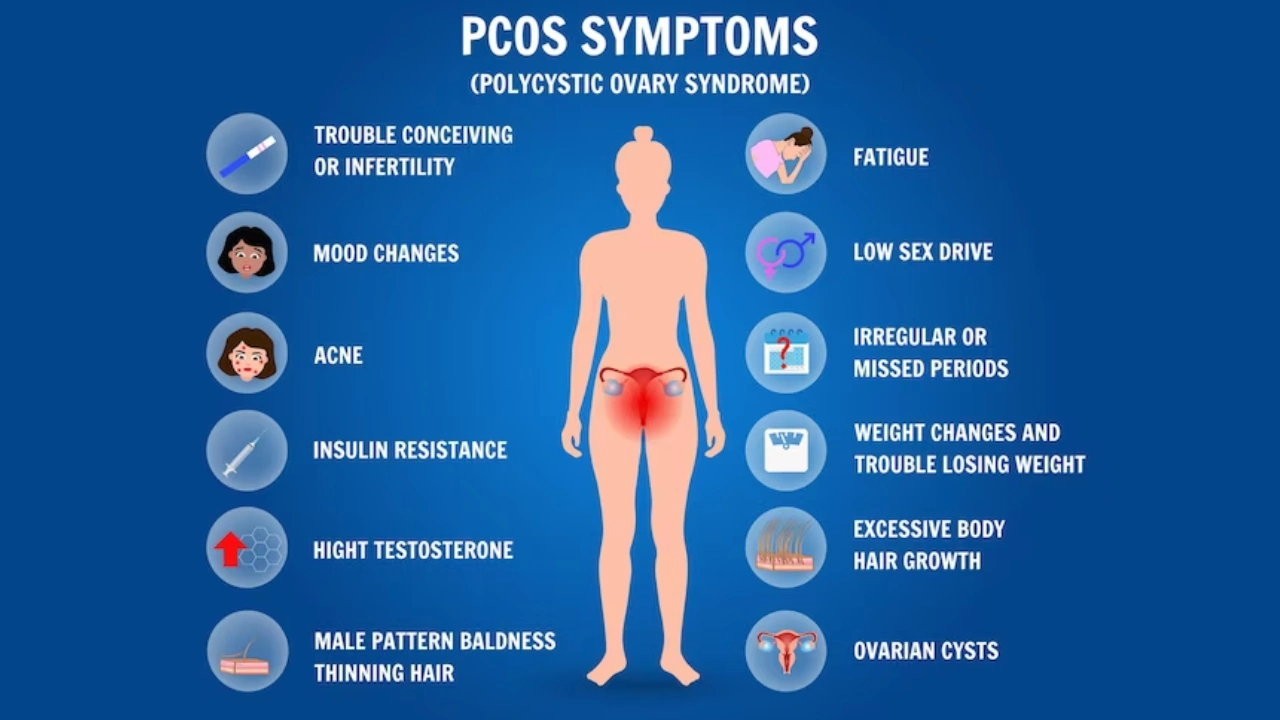 Initial Symptoms and Diagnosis of PCOS